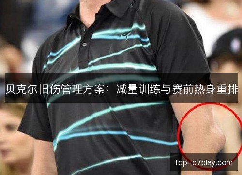 贝克尔旧伤管理方案：减量训练与赛前热身重排